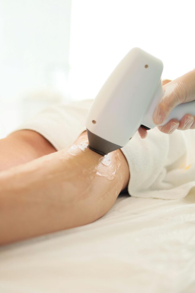 Depilación Laser